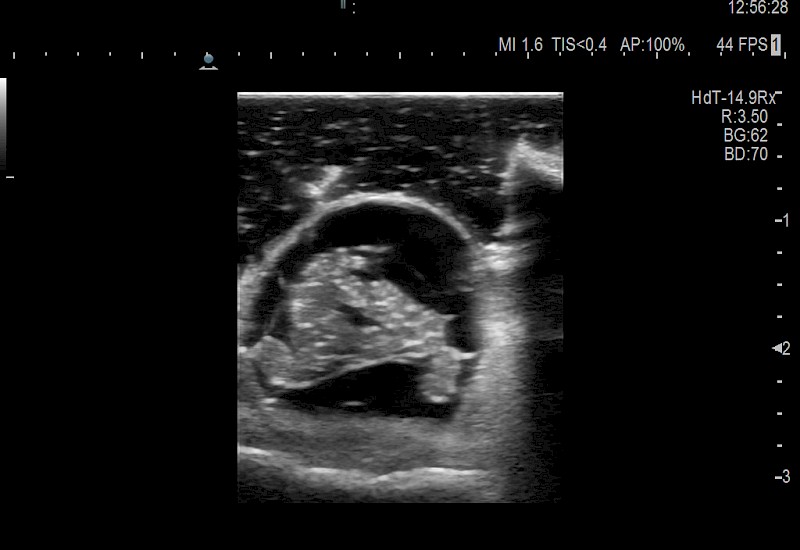 Intraop Spine Cross Section
