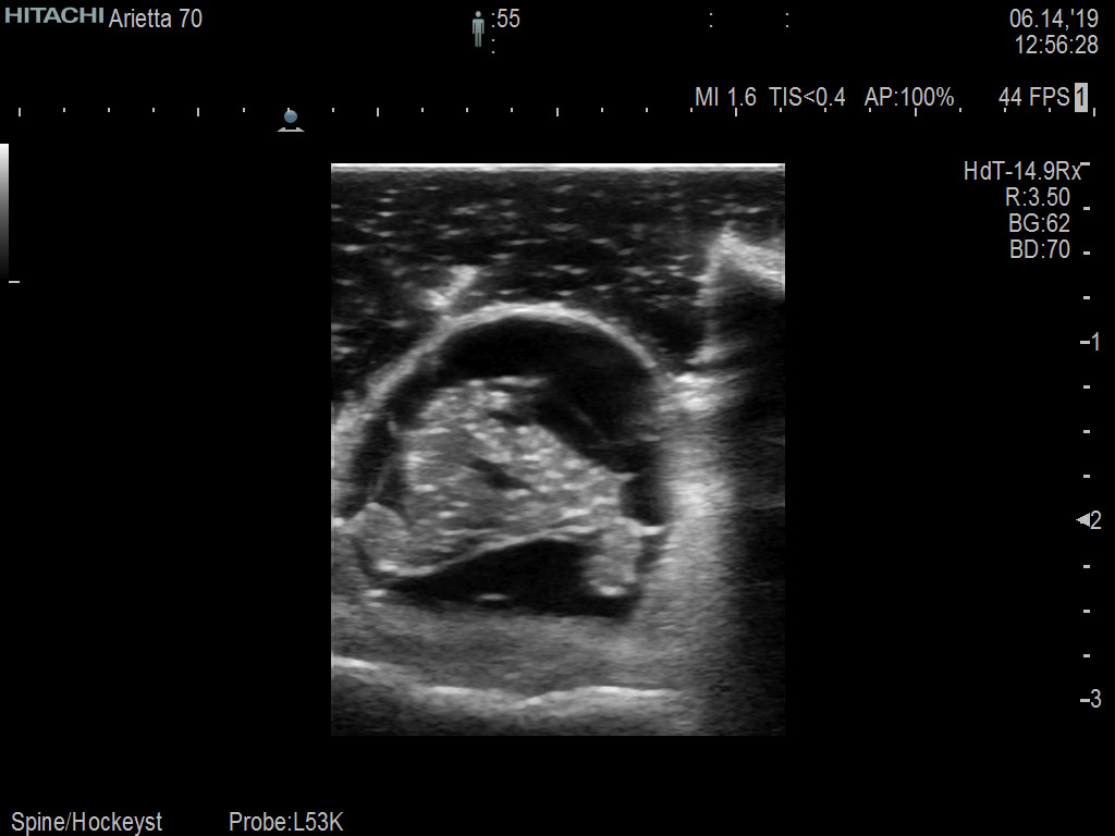 Intraop Spine Cross Section